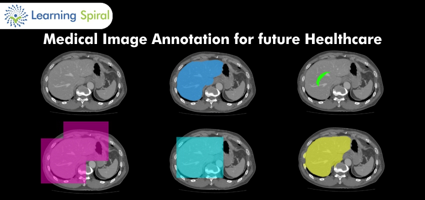 Data Annotation