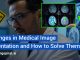 Medical_Image_Segmentation